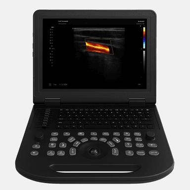 HP-A11 Notebook Color Doppler